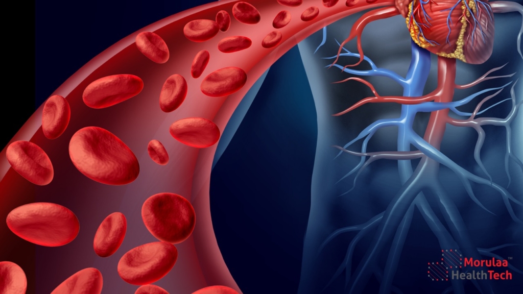 Cardiovascular as Medical Device in India - Non Notified Medical Device Registration