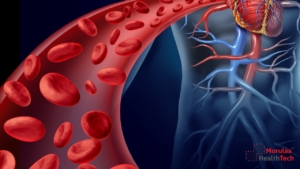 Cardiovascular as Medical Device in India - Non Notified Medical Device Registration