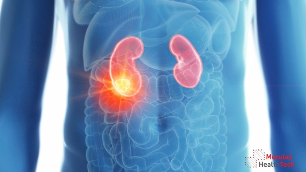 Urology as Medical Device in India - Non Notified Medical Device Registration