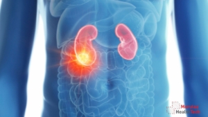 Urology as Medical Device in India - Non Notified Medical Device Registration