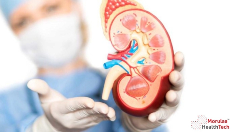 Nephrology and Renal Care as Medical Device in India - Non Notified Medical Device Registration