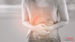 Gastroenterology as Medical Device India-Non Notified Medical Device Registration