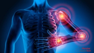 Rheumatology as Medical Device India-Non Notified Medical Device Registration