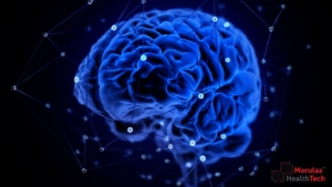 Neurology as Medical Device India-Non Notified Medical Device Registration